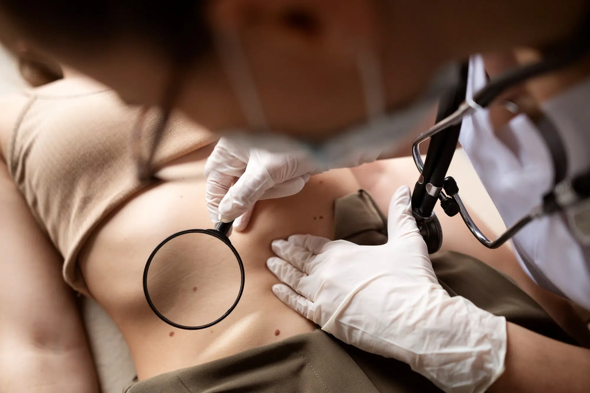Arzt untersucht Muttermale am Bauch einer Patientin